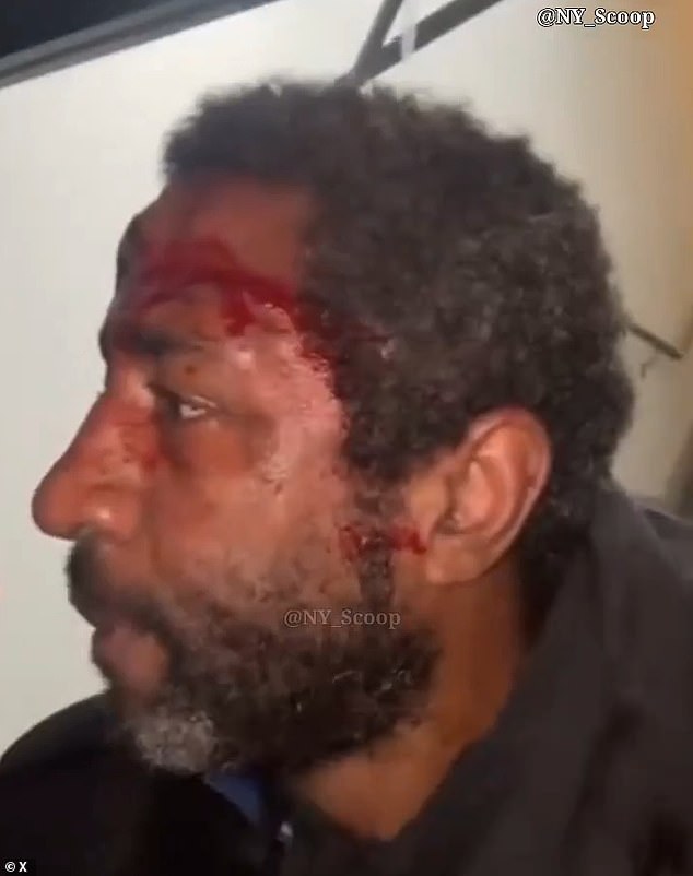 Un ‘escupidor en serie’ que atacaba a mujeres blancas fue golpeado en la calle por una pandilla