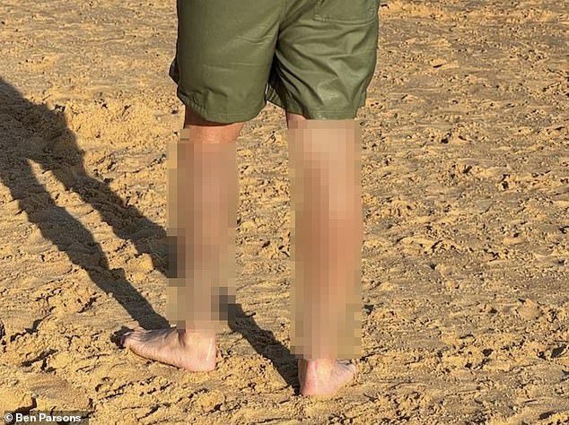 Un hombre que fue interrogado tras un paseo por la playa en Nochebuena se tatuó un símbolo neonazi