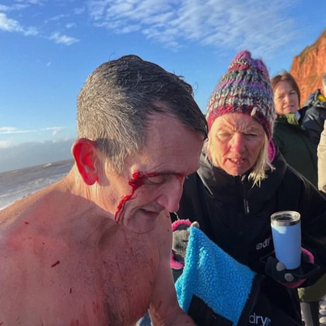 Un superviviente de la natación del día de Navidad que se cree que mató a dos personas dice que fue un “error entrar” después de ser rescatado de las “peores condiciones jamás vividas”