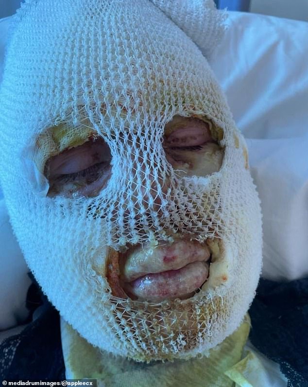 Dos primos sufrieron horribles quemaduras faciales después de que explotara el calentador de un pub, escuchó un tribunal