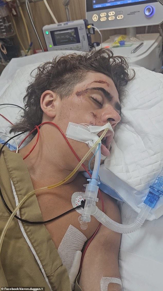 Llamamiento urgente de la familia para ayudar a repatriar al adolescente británico gravemente herido en un accidente de tráfico en Tailandia