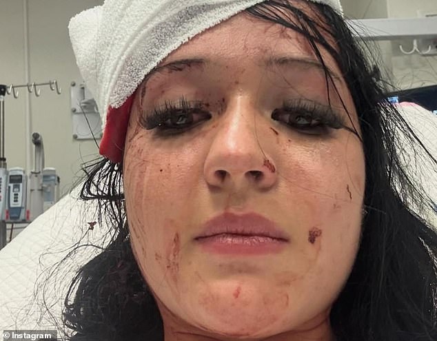 La hermana de una mujer de 20 años que supuestamente mató a puñaladas a su compañero en un club de Leagues describió el horrible ataque y elogió al héroe que la salvó.