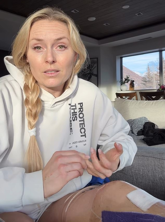Lindsey Vonn habla sobre las luchas mentales “oscuras e implacables” después del desastre de los Juegos Olímpicos de Invierno: “Me golpeó como una tonelada de ladrillos”
