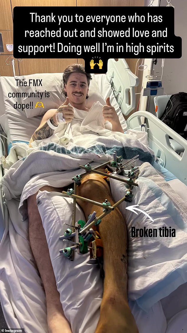 El mensaje de un piloto de motocross herido desde el hospital después de un accidente fatal en el Sydney Royal Easter Show: revela que su esposa embarazada tiene un “largo camino por recorrer”