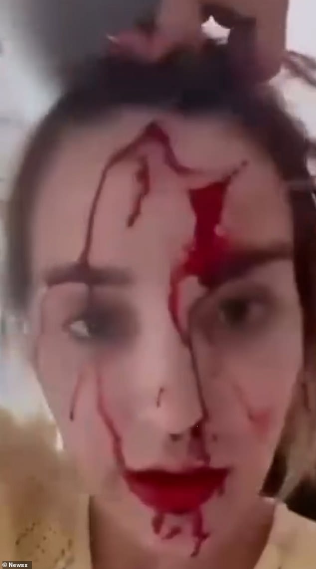 Miss Venezuela Global publica impactantes imágenes de ella misma cubierta de sangre en una habitación de hotel destrozada después del ‘ataque a una celebridad estilista’
