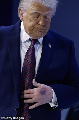 La Casa Blanca publicó los resultados del examen físico de Donald Trump en medio de creciente presión