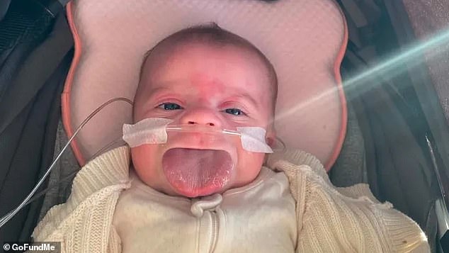 La valiente batalla de la bebé Lulu contra un raro trastorno genético que hace que la lengua crezca hasta alcanzar un tamaño enorme: el mundo familiar está patas arriba