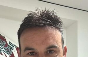 Landon Donovan revela una nueva apariencia dramática solo unos días después de que le pida ayuda a los fanáticos en caso de una falla en el trasplante de cabello