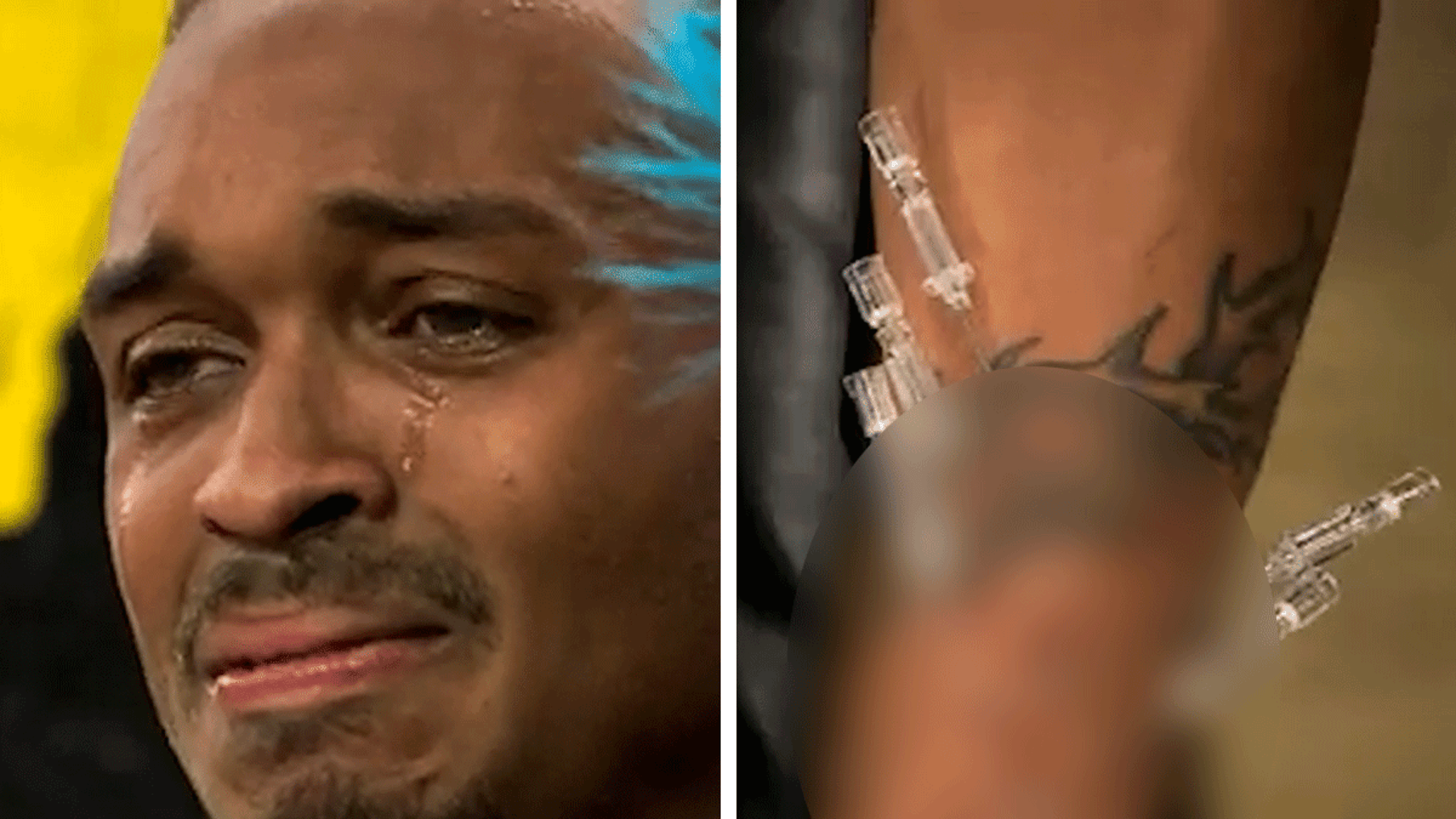 Concursante de ‘Fear Factor’ atravesado por 11 agujas en un clip desgarrador