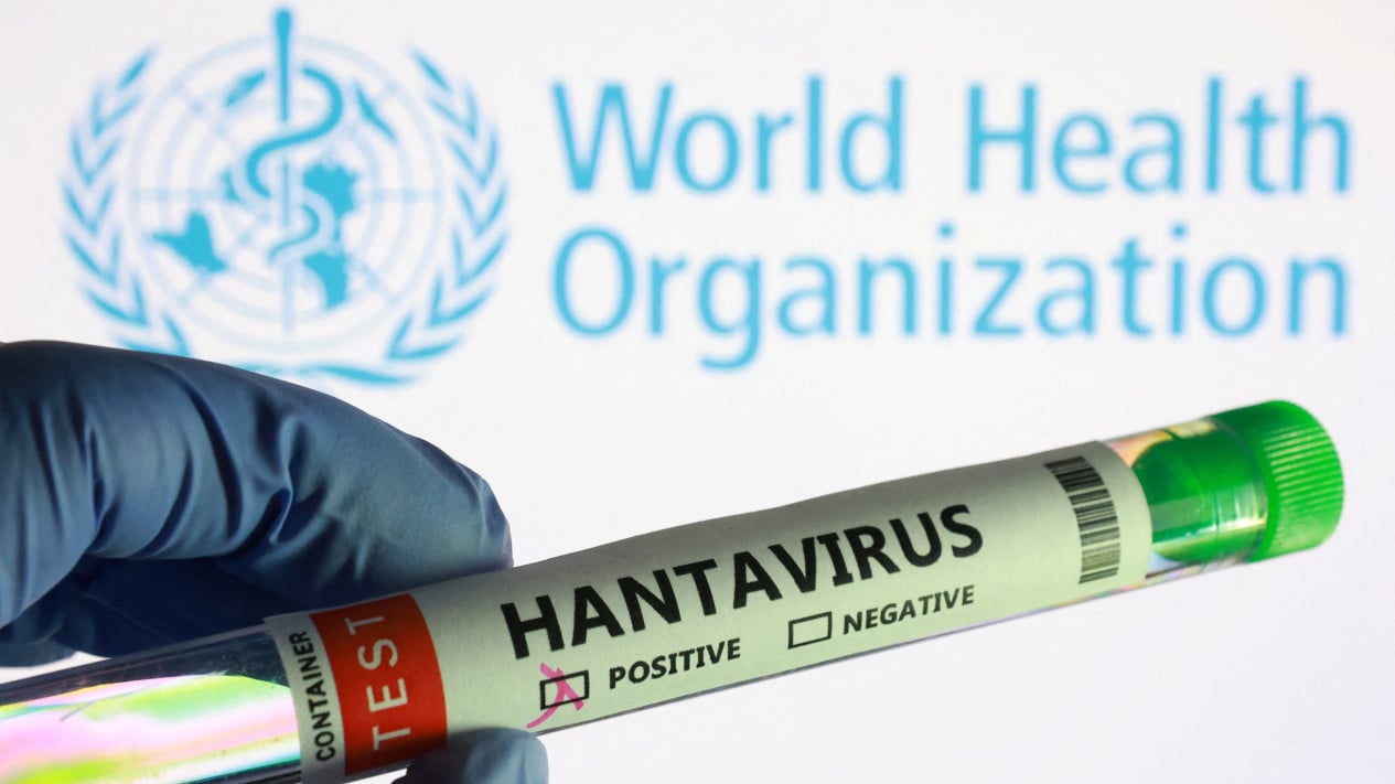 Taipei ha confirmado un caso de muerte por hantavirus