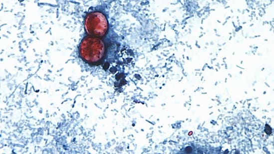 ¿Qué 9 estados americanos se ven afectados por la epidemia de Cyclospora? Lista completa mientras los CDC emiten una nueva advertencia