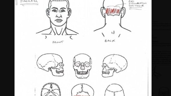¿Quién es el Dr. Roger Mitchell? Todo lo que sabemos sobre el médico forense que realizó la autopsia de Nolan Wells