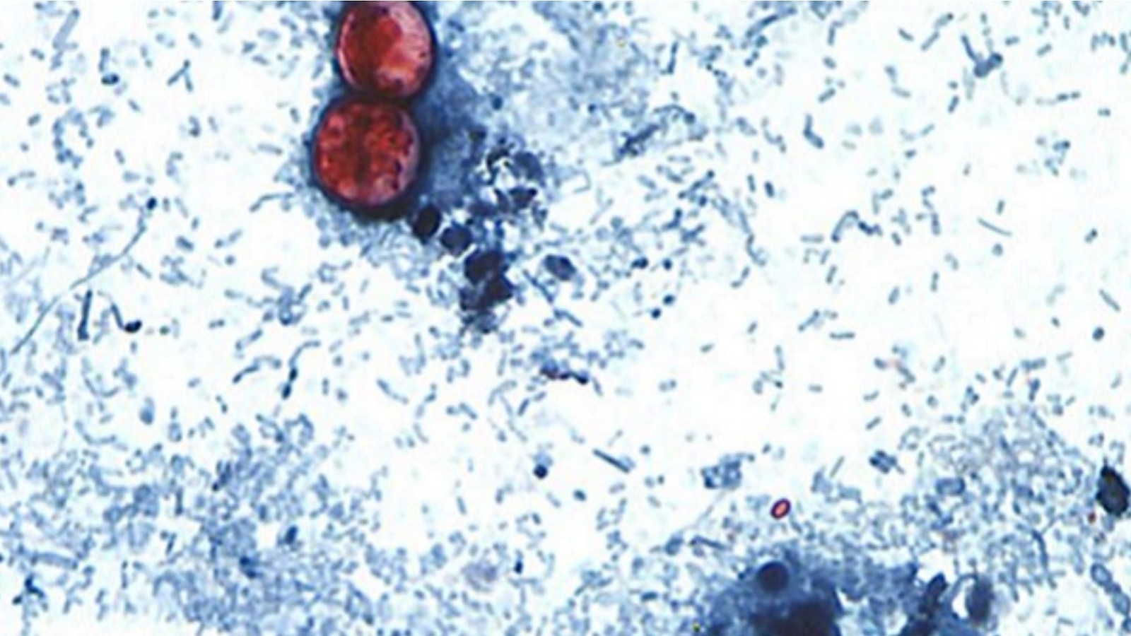 Los casos de ciclosporosis en Michigan superan los 2.600, dicen funcionarios de salud