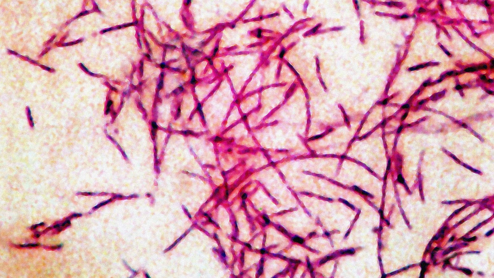 legionnaires-disease-stock-gty-jef-191021_hpMain_2_16x9.jpg