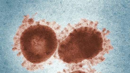 ¿Qué se está propagando el “virus del vómito” en los Estados Unidos? Todo lo que necesitas saber sobre el virus estomacal altamente contagioso