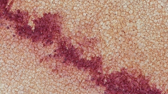 Brote de ciclosporiasis en Estados Unidos: todo lo que necesita saber sobre síntomas, propagación, tratamiento y prevención